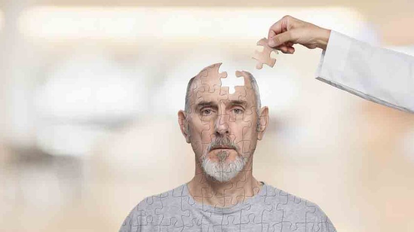 Las células inmunes pueden ser una terapia potencial para el Alzheimer