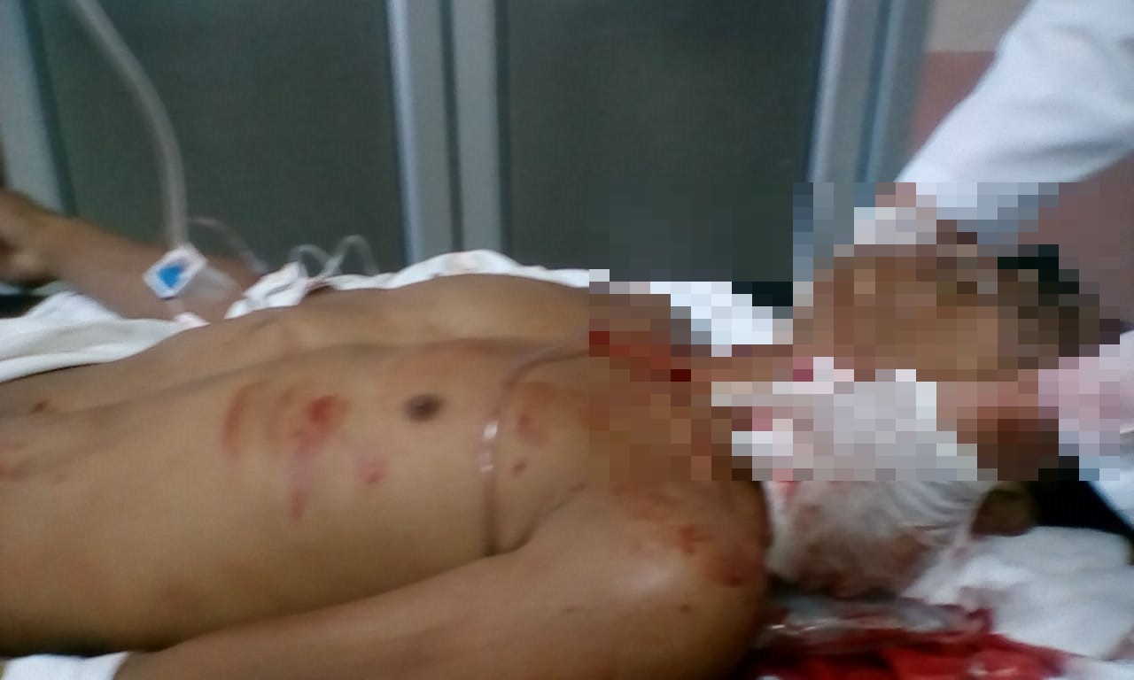 Con grave herida en el cuello ingresa hombre al Hospital del Sur