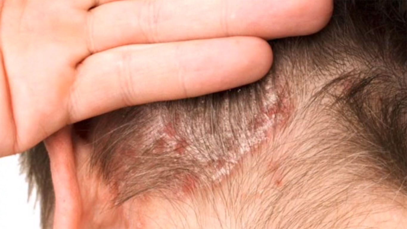 Imagen de cuerpo de nota