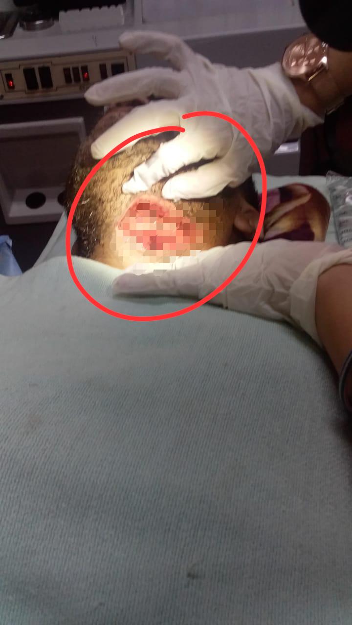 Imagen de (FOTOS SENSIBLES) Los criminales pretendían degollar al profesor Jaime Rodríguez