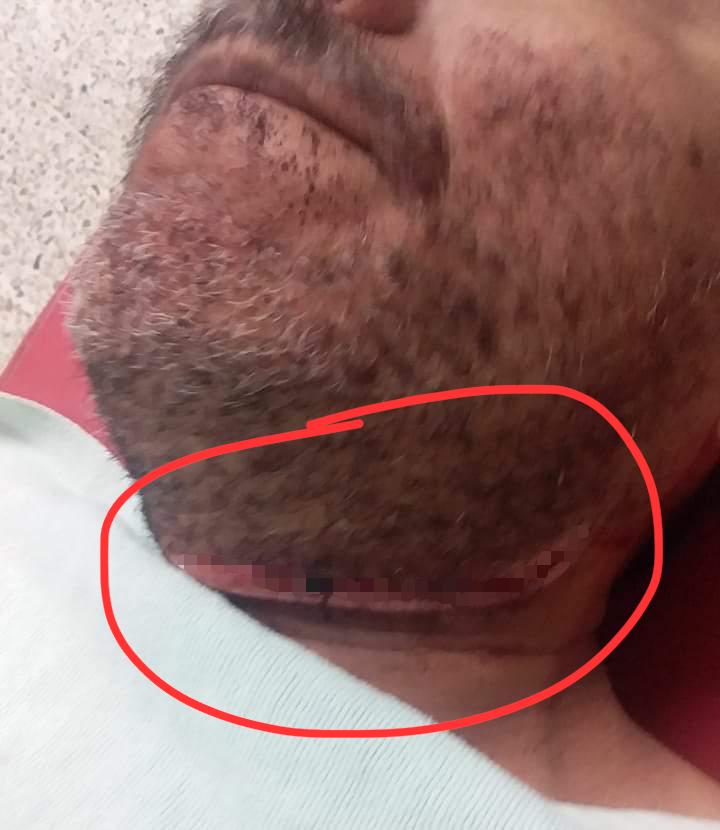 Imagen de cuerpo de nota