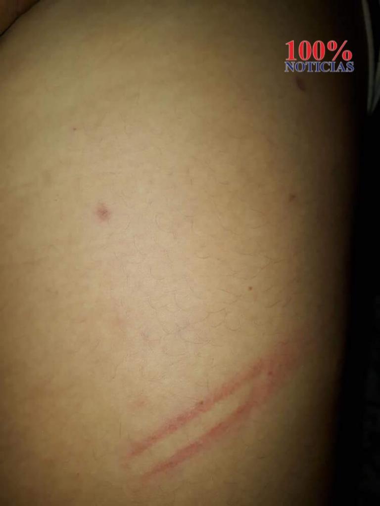 Imagen de cuerpo de nota