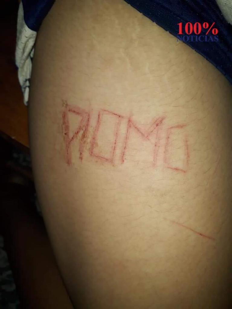 Imagen de cuerpo de nota