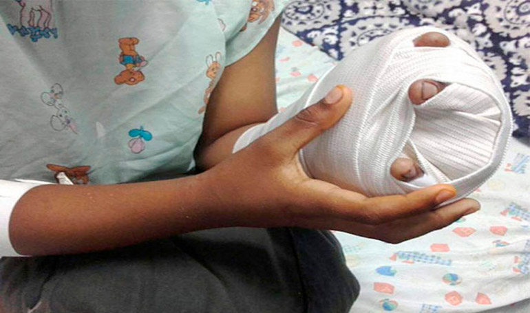 Más de 20 mil lempiras es el costo diario por cada niño quemado en Honduras