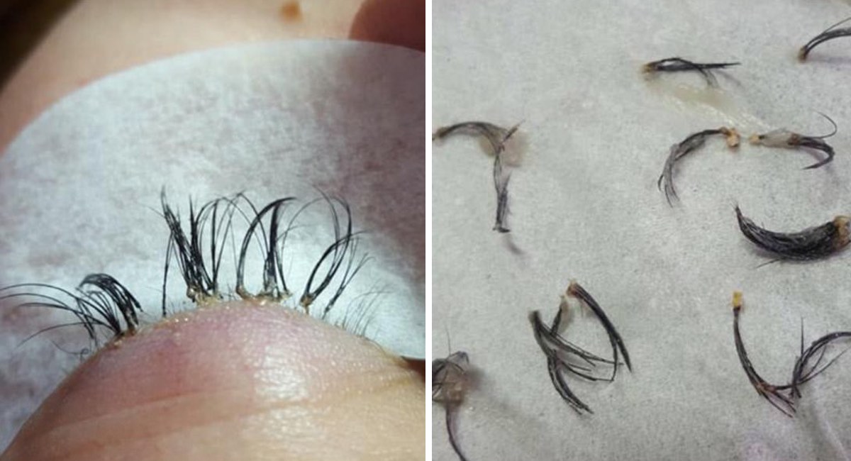 Pestañas postizas: una mirada sexy, pero con efectos secundarios