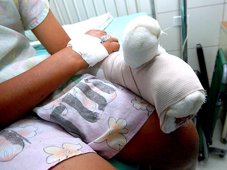 Dos menores y un adulto han resultado quemados por manipular pólvora en Honduras