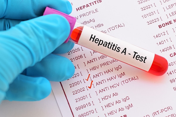 Más de mil 400 casos de hepatitis A se contabilizan en Honduras