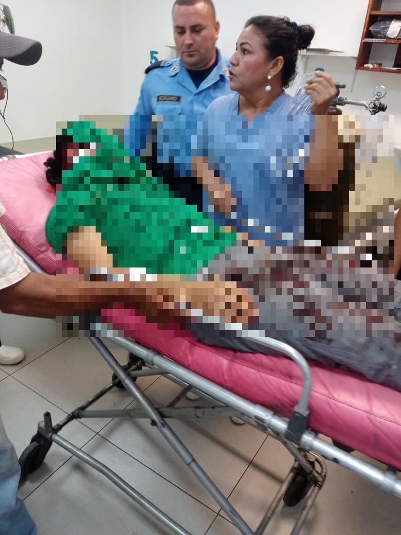 Explosión de bomba molotov desfigura rostro de joven en Choluteca