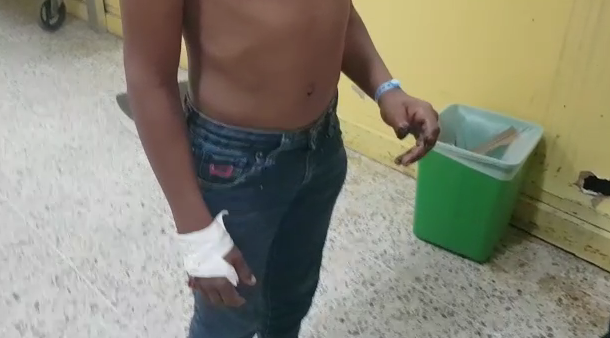 Amputan dedo a menor por manipulación de pólvora en la zona Sur