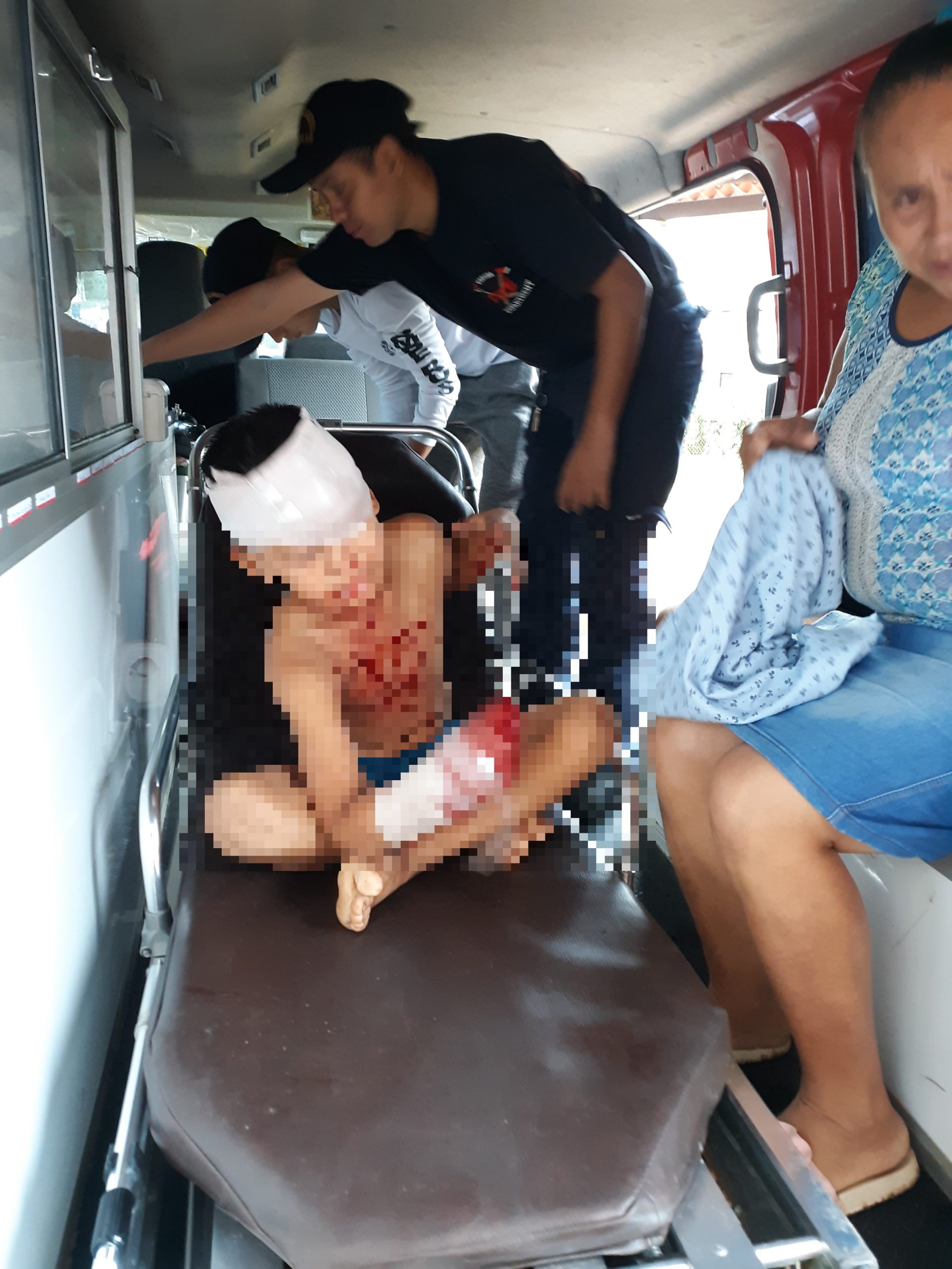 Menor de 8 años resulta gravemente lesionado por manipulación de pólvora