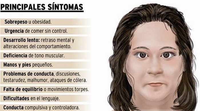 Enfermedad que te hace engordar.