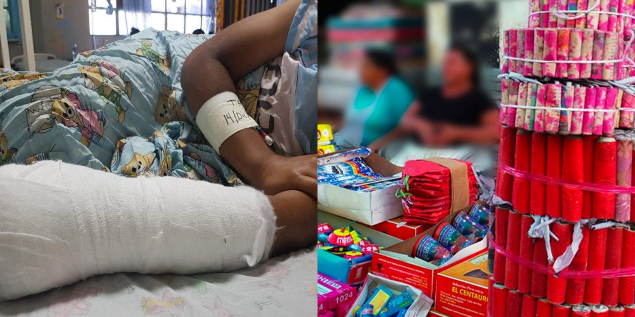 ¡Lamentable! Cuatro menores han resultado con quemaduras producto de pólvora en Honduras