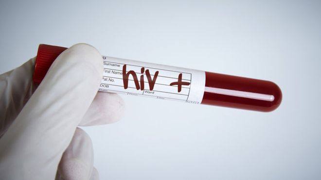 ONU se registra un aumento del 7 por ciento en infecciones de VIH en Honduras