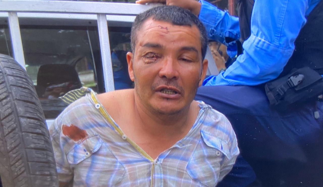 Ciudadano le arrebata arma de fuego a guardia de seguridad en hospital y provoca el caos
