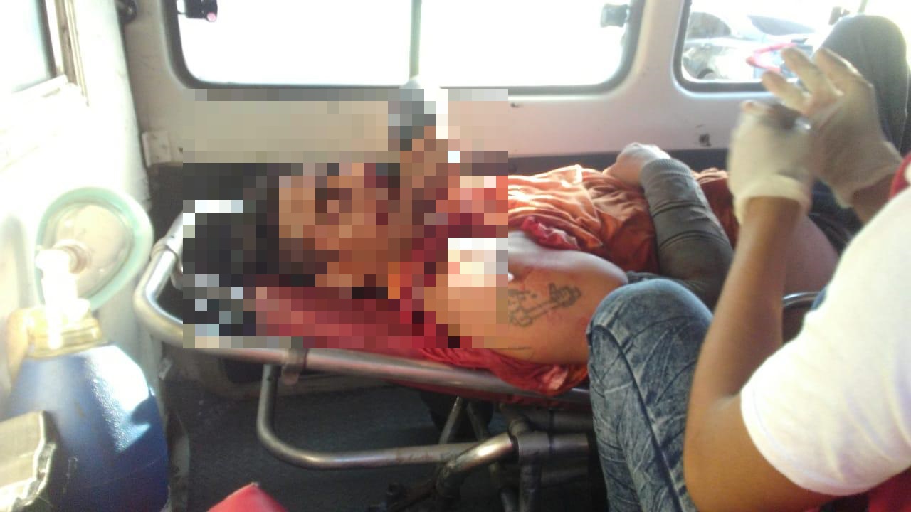 Frustran asalto: ladrón resulta lesionado y es trasladado al Hospital con pisto en mano