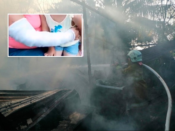Madre resulta con quemaduras tras rescatar a sus hijos de un incendio en San Pedro Sula