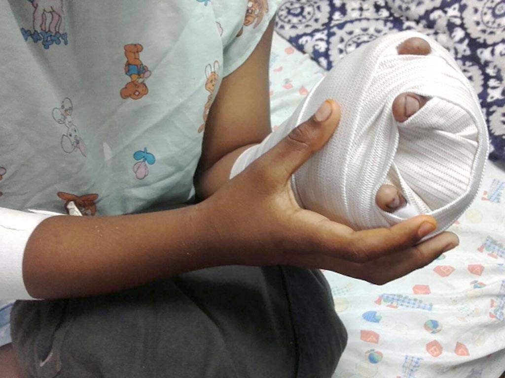 ¿De cuánto es la multa qué se le aplicó a los padres de niños quemados por pólvora en Honduras?