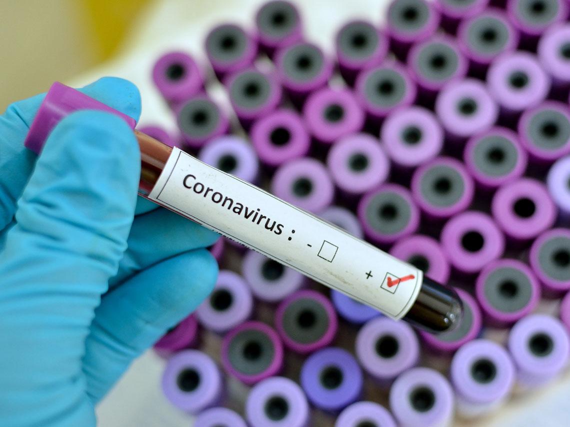 No existe caso de coronavirus confirmado en Honduras, afirmó Secretaría de Salud