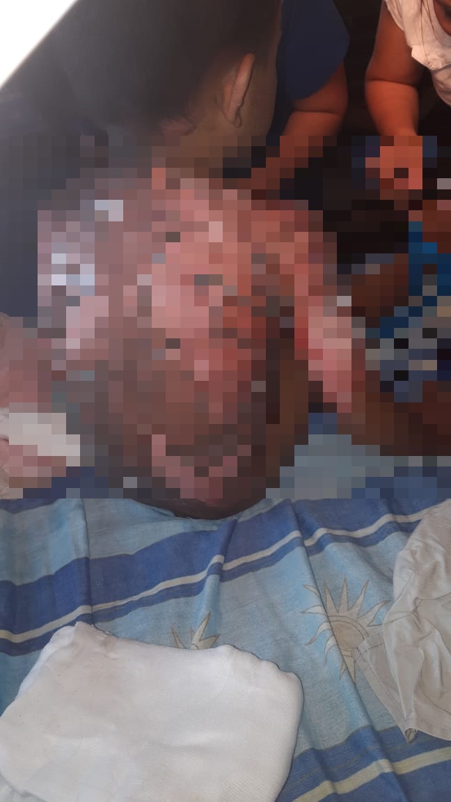 Menor resulta con graves quemaduras, tras caerle agua caliente
