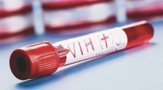 Sin tratamiento, pacientes son capaces de controlar el VIH