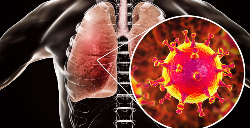 Coronavirus se extiende y OMS alerta sobre riesgo de pandemia