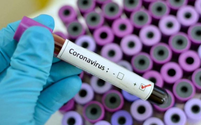 Se confirman dos nuevos casos de coronavirus y la cifra se eleva a 8 en Honduras