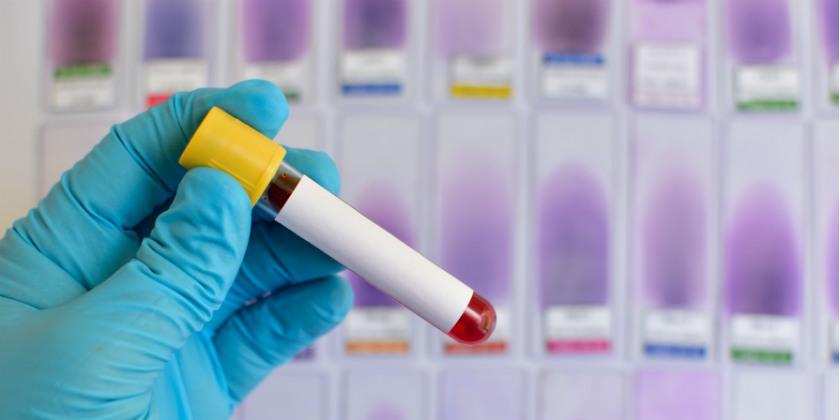 Coronavirus una pandemia más cerca de Honduras