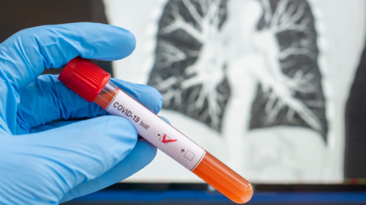 Coronavirus: ¿Quiénes son los fallecidos por covid-19 en Honduras?