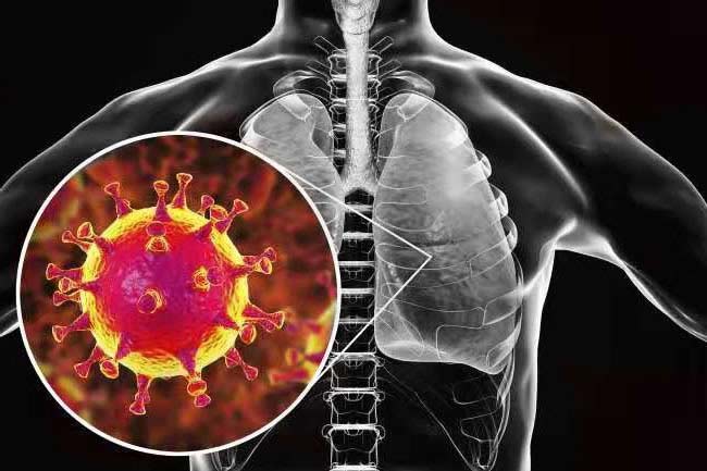 Así mata el coronavirus, desde el cerebro hasta los dedos de los pies