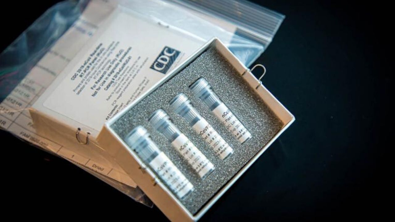 Coronavirus: Argentina crea test para detectar covid-19 en una hora, con 98 por ciento de confiabilidad