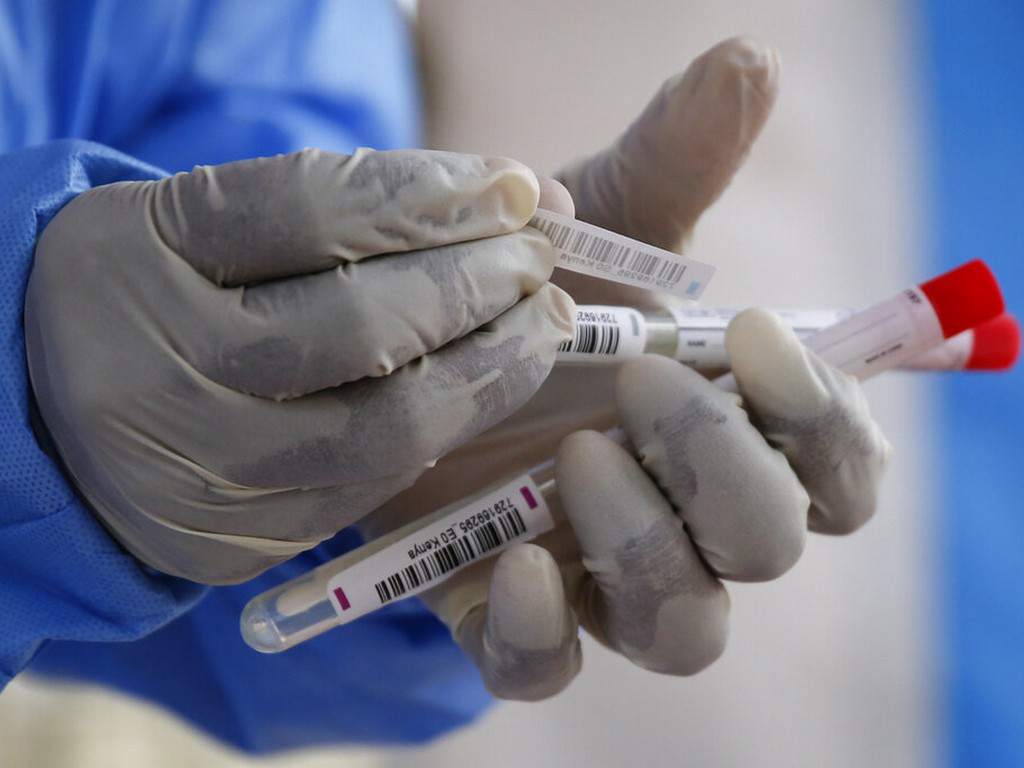Flaquezas de lucha contra el covid-19 en Honduras: apenas 8,000 pruebas y un poco más de dos centenares de recuperados