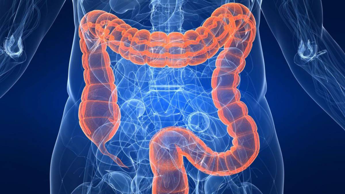 Científicos encuentran nueva forma de tratar el cáncer de colon