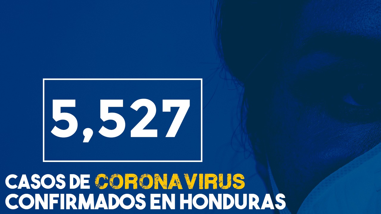 Imagen de A 5,527 sube la suma de contagiados por covid-19 y 225 los fallecidos