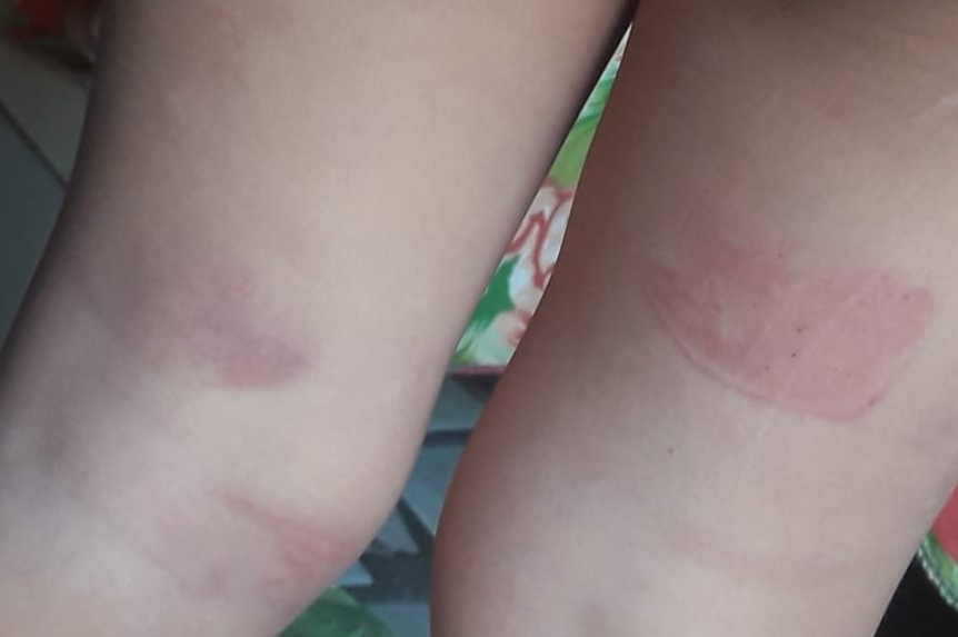 Detienen a hombre por castigar a su hijo de cuatro años con una faja en el Distrito Central