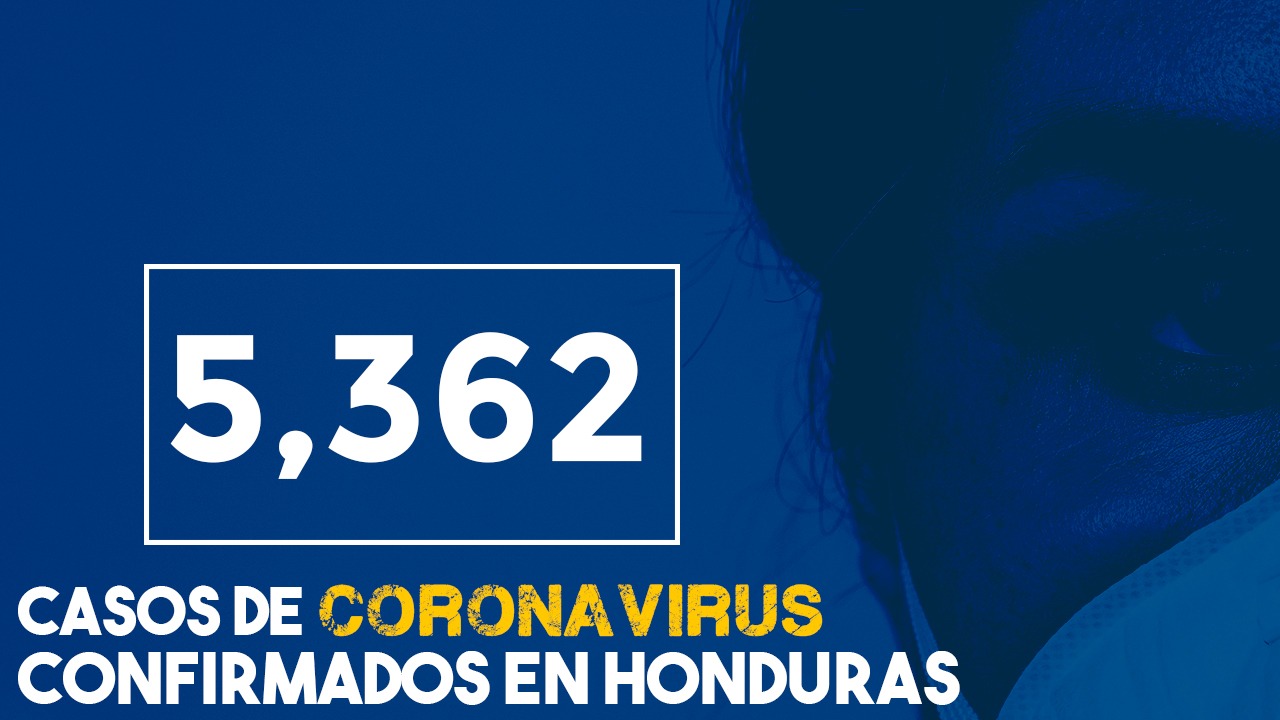 Coronavirus en Honduras: 5,362  personas contagiadas y 217 muertos