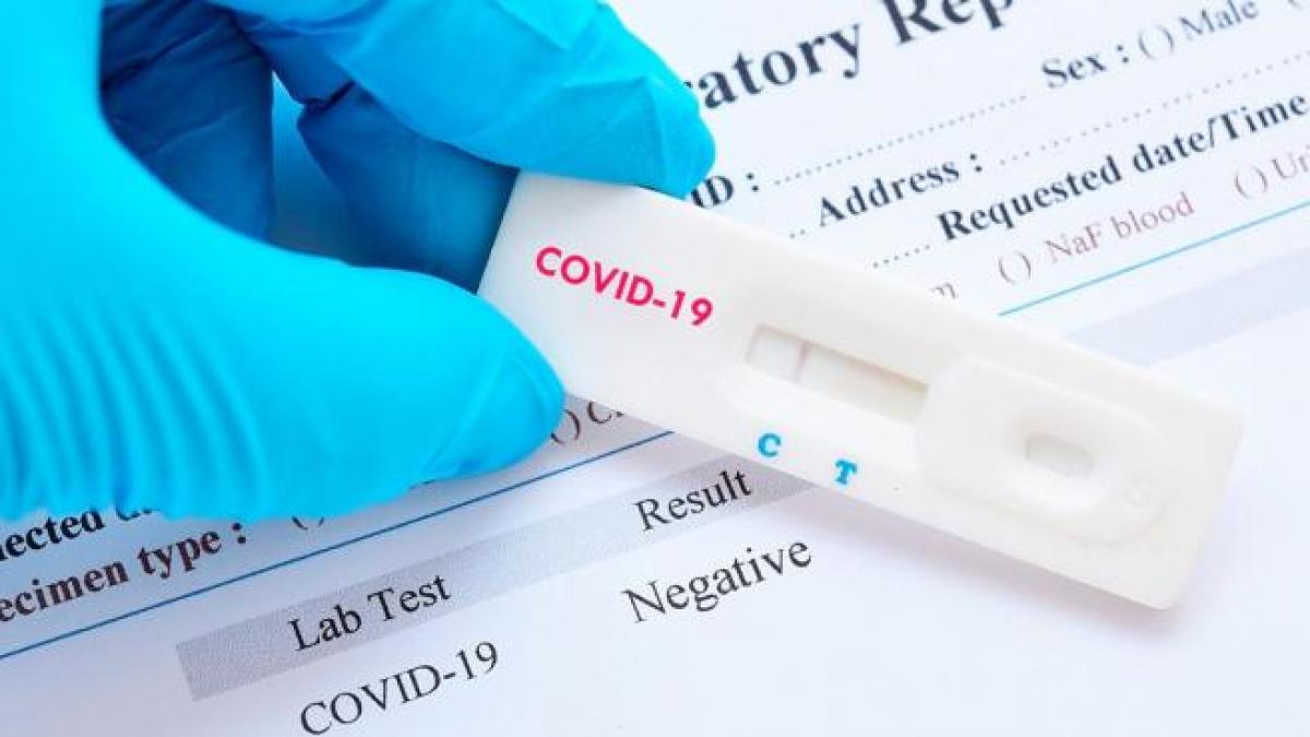 Hasta en carnicería y en Facebook venden pruebas rápidas para detectar el coronavirus, asegura microbiólogo hondureño