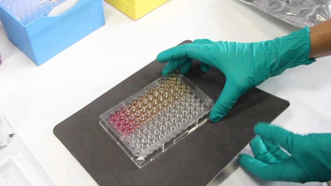 ¿En qué consiste la prueba Elisa que adquirió el IHSS para detectar el covid-19 en tiempo real?