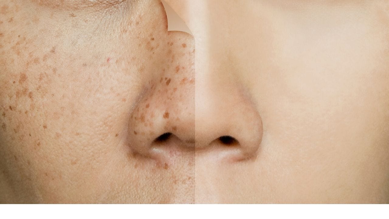 Olvídate de las manchas en la piel con exfoliante natural a base de arroz, leche y azúcar, ¿cómo prepararlo?