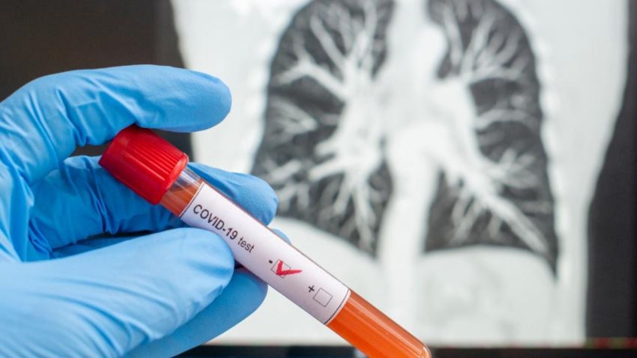 Colegio de Microbiólogos explica la razón en la baja de pruebas para detectar el covid