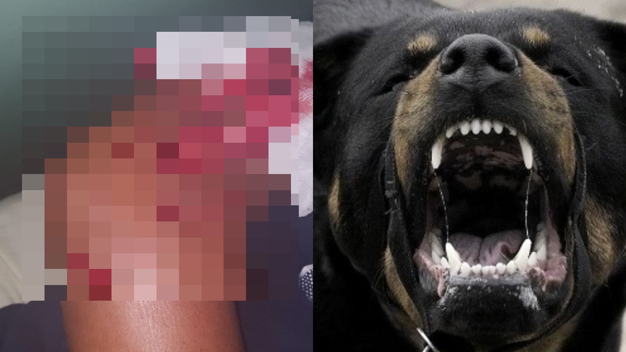 Imagen de Tres perros rottweiler atacan y provocan varias heridas en su cuerpo a un joven en Marcala