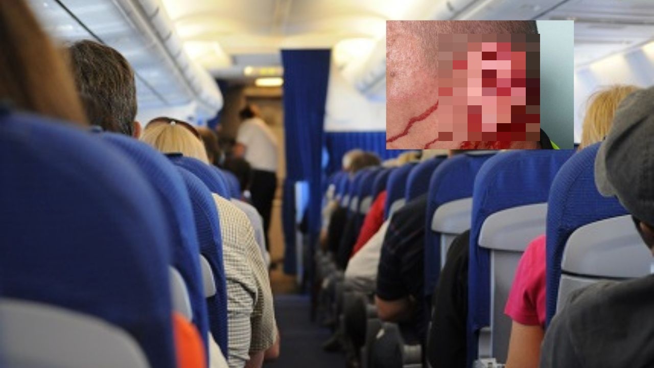 Hombre ebrio le arranca la oreja a un pasajero de avión por disputarse una bebida