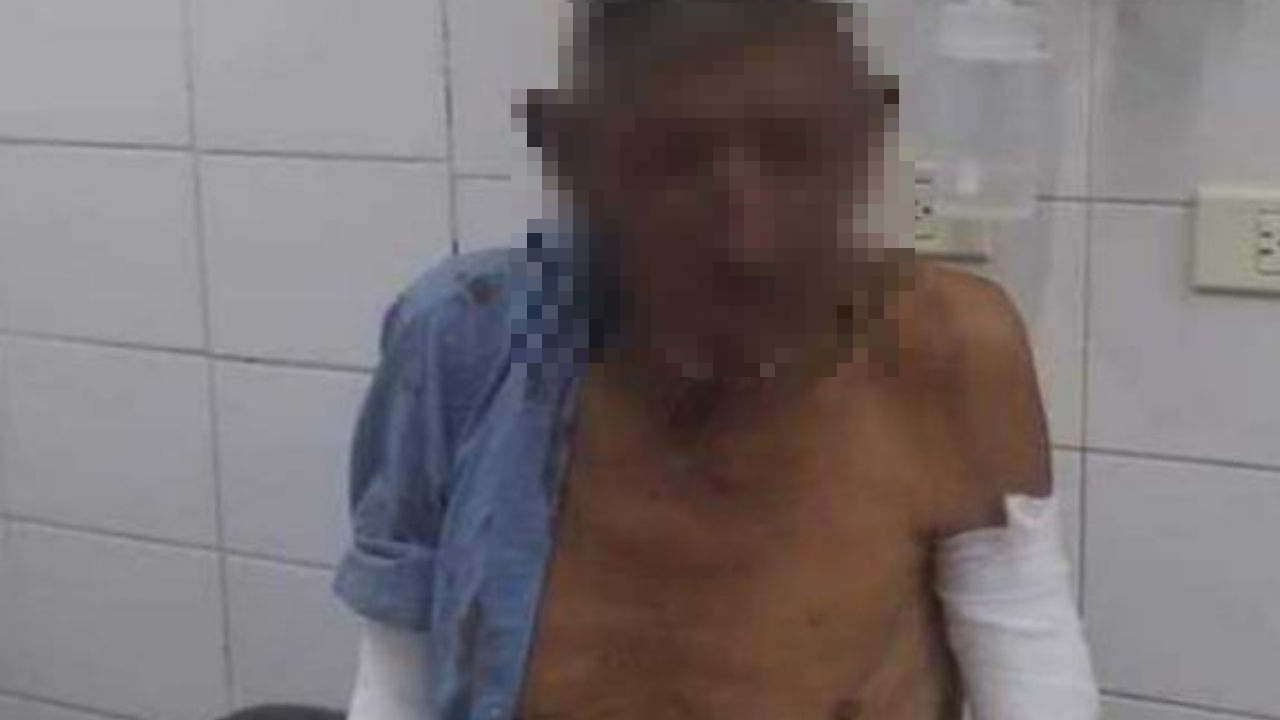Hondureño da brutal golpiza a su tío de 81 años de edad en el oriente de Honduras