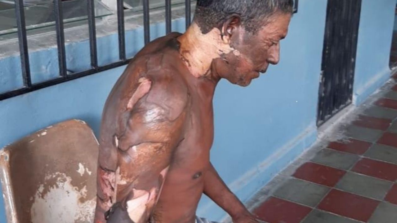 Imagen de Hombre quemó y mató a su amigo 'al calor de los tragos' en Comayagua