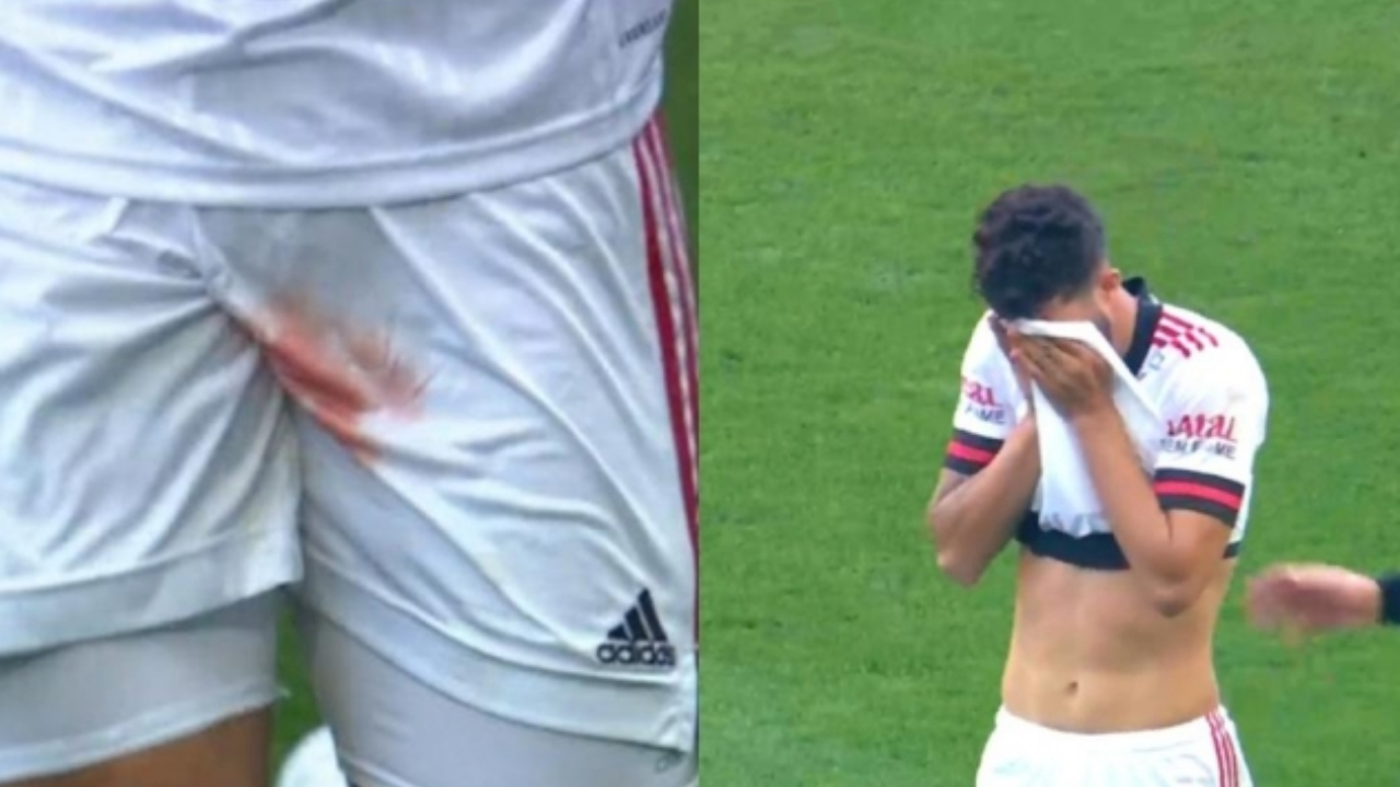 Jugador sufre espeluznante corte en un testículo en pleno partido del Flamengo de Brasil