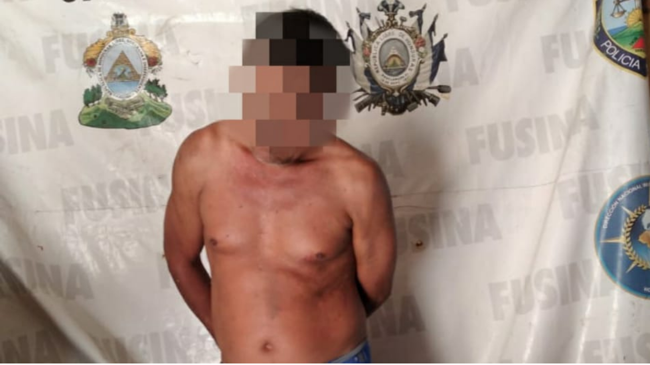 Hondureño trató de dar muerte a su propia madre en San Lorenzo