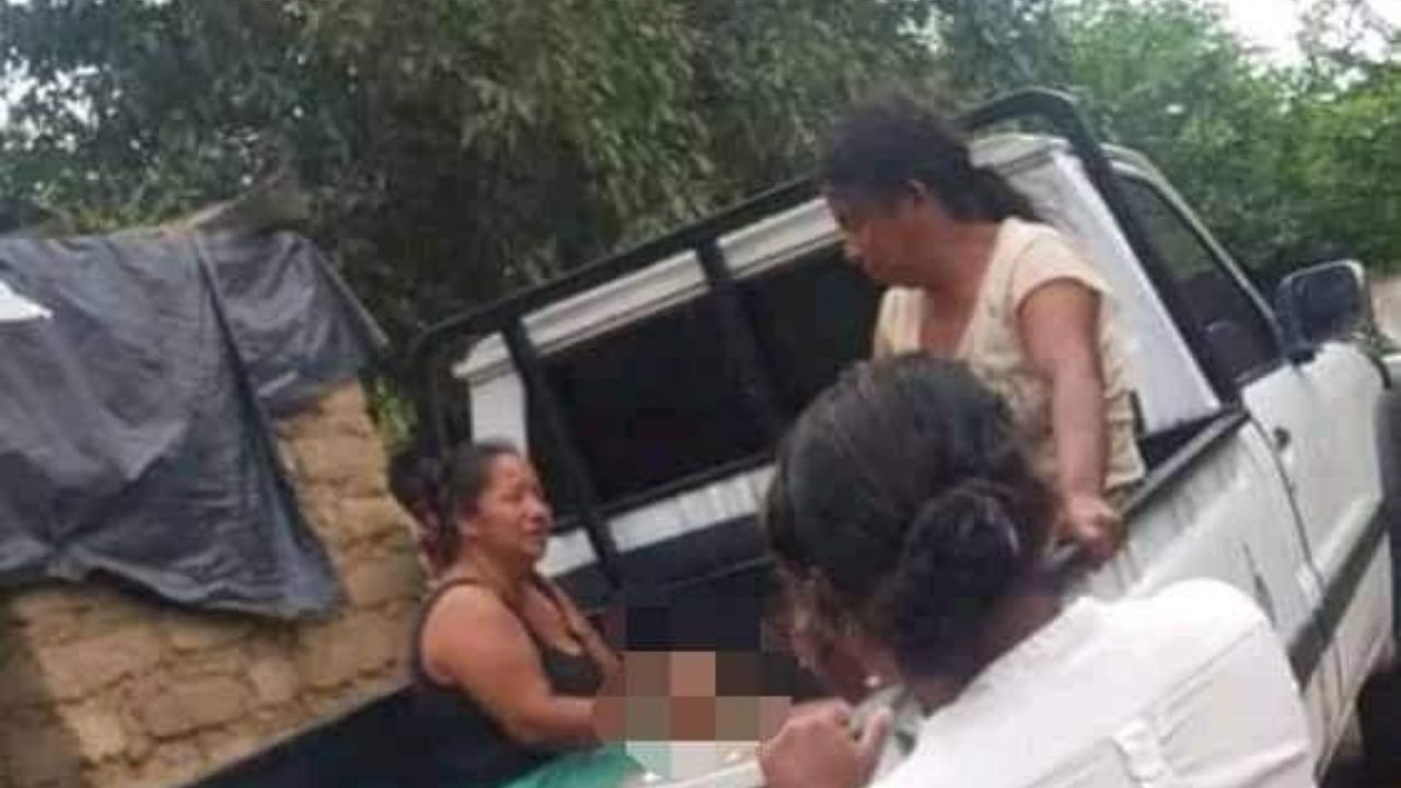 Hondureño fallece tras explotarle un mortero en su estómago previo a Navidad