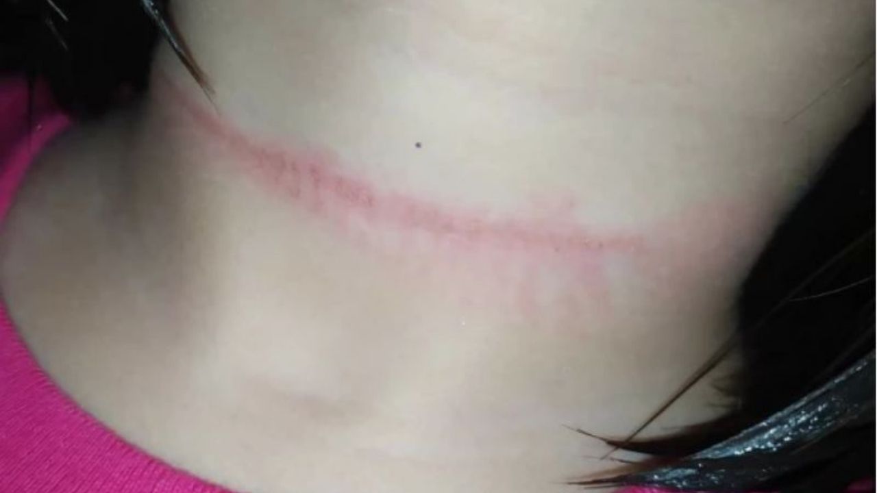 Una mujer relató cómo salvó a su hija de morir ahorcada por culpa de un reto de TikTok, de qué se trata