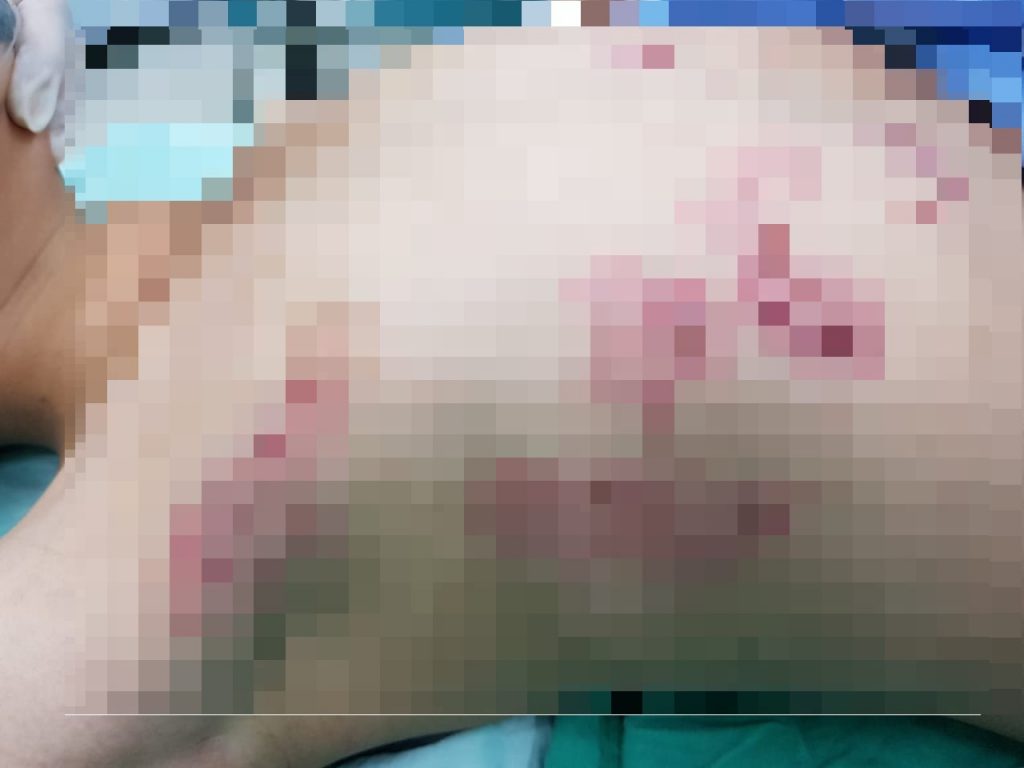 Imagen de cuerpo de nota