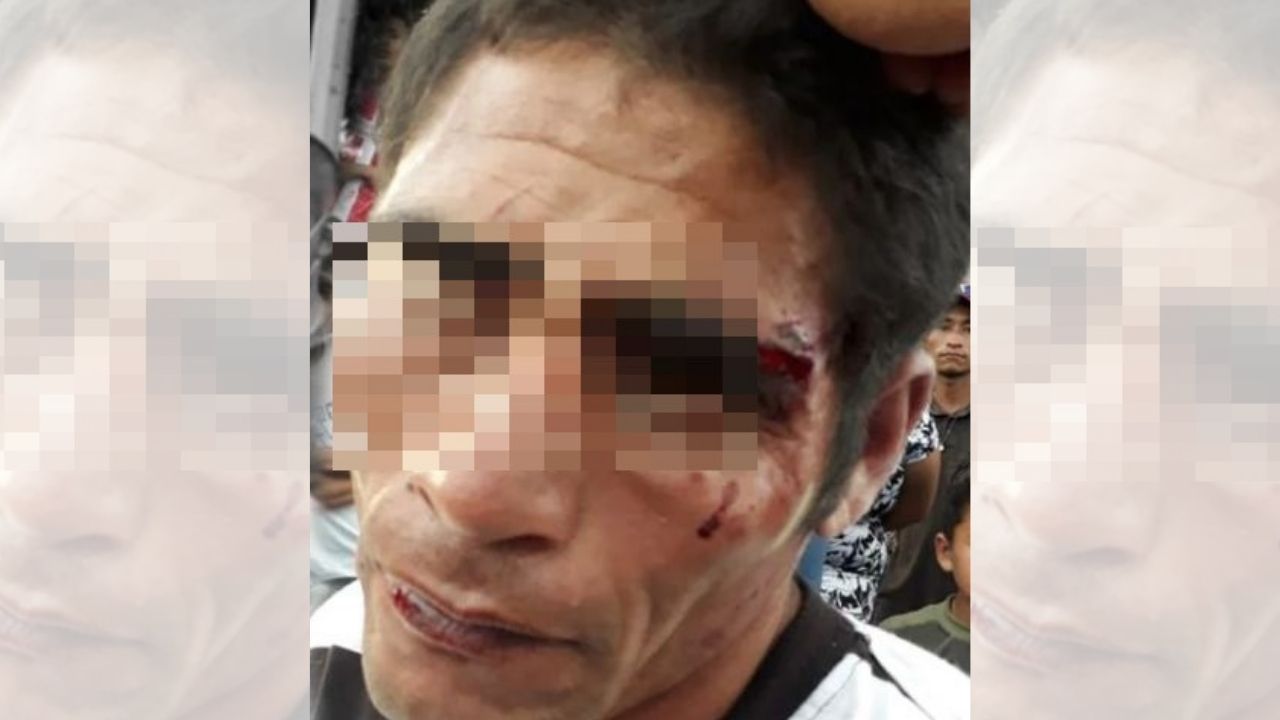 Hondureños dan golpiza a hombre porque supuestamente trató abusar de un menor con capacidades especiales