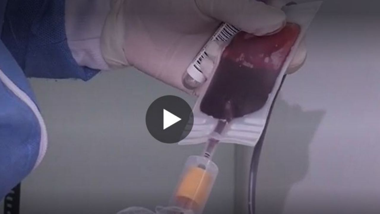 En video: Así es la vida de un joven que necesita una transfusión de sangre cada 15 días